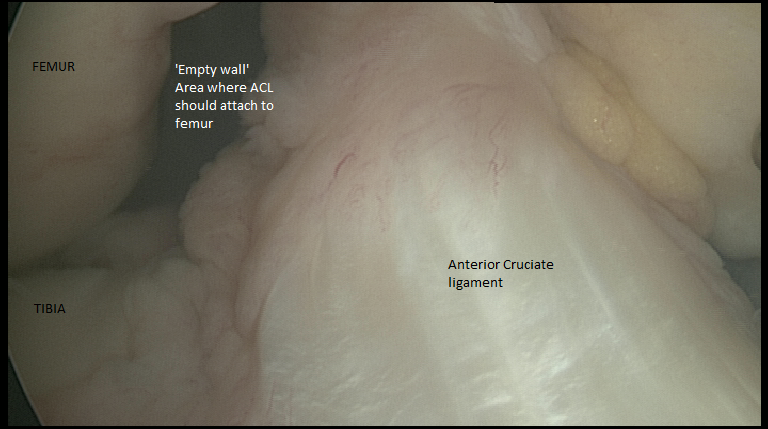 Annotated ACL 1